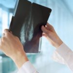 Uncovering Mechanisms Driving Estrogen Receptor-Negative Breast Cancer