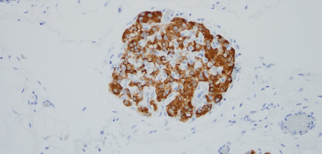 This histological image shows the presence of insulin within the islets (brown stain). Photo: Guillermo Ameer/Northwestern University