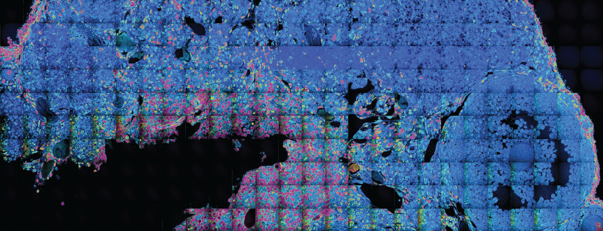 Long-Lived Proteins Impact Aging of Female Reproductive System