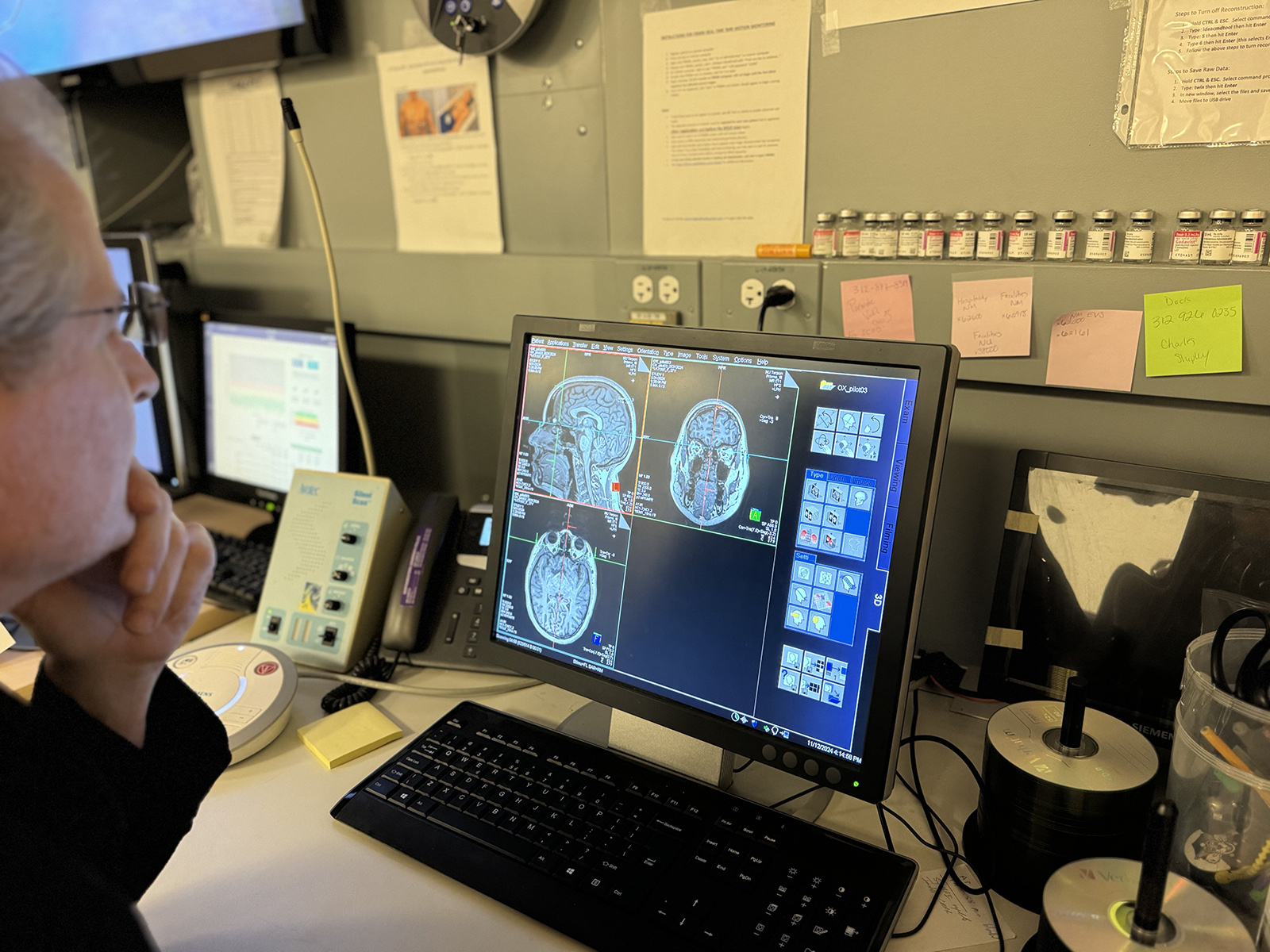 Imaging Study Provides New Understanding of Brain Communication and Social Interaction